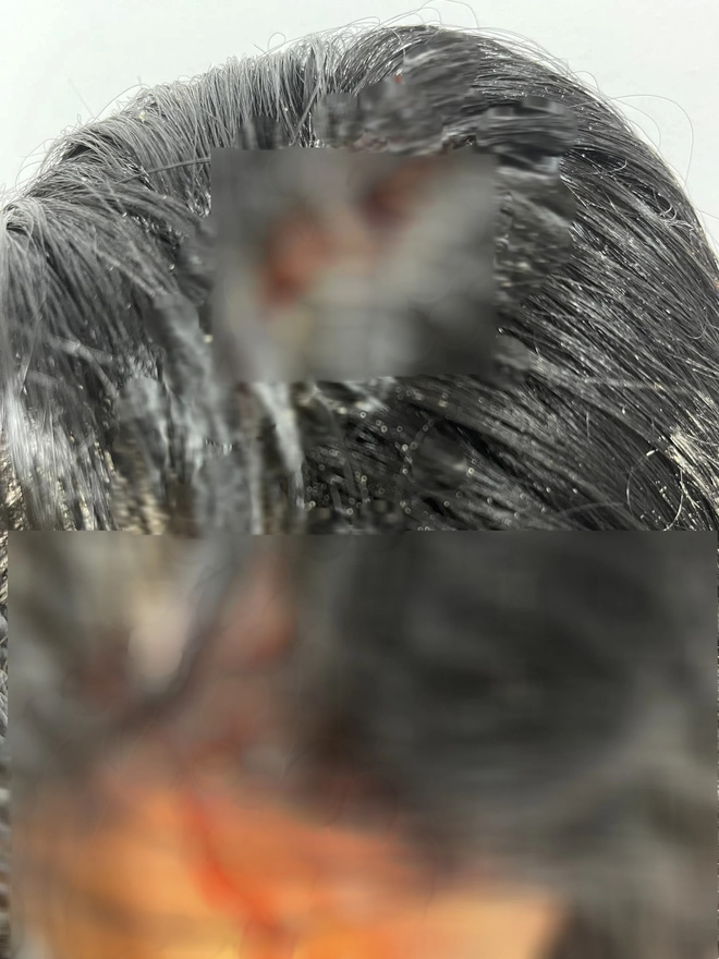 Nữ siêu mẫu Vbiz tung ảnh thương tích đầy mình, bị giam trong nhà đánh đập suốt 1 năm, cắt cả tóc, dí đầu vào bồn cầu-6