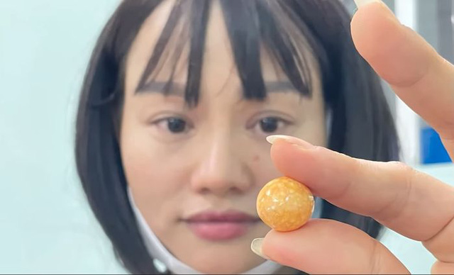 Cắn phải ngọc quý khi ăn ốc giác, một gia đình Vũng Tàu hô bán 8 tỷ đồng!-3