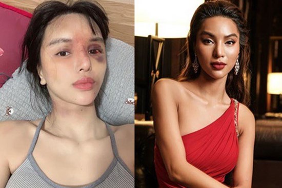 Phía Khả Trang lên tiếng, cung cấp bằng chứng và đơn tố giác tường tận chuyện bị chồng giam lỏng, bạo hành dã man