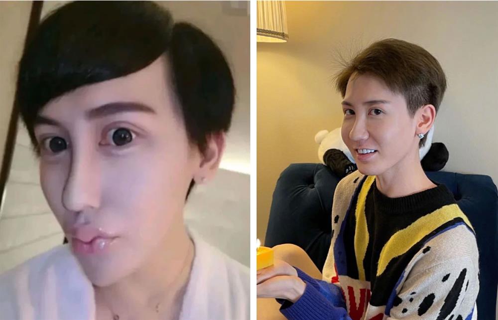 Chàng trai mặt rắn” nổi đình đám xứ Trung vì quá dị sau 5 năm giờ ra sao? Nhan sắc hiện tại khiến một số người lại muốn quay xe xin lỗi-9