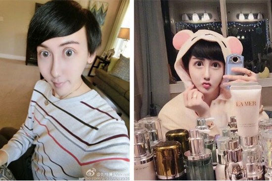 “Chàng trai mặt rắn” nổi đình đám xứ Trung vì quá dị sau 5 năm giờ ra sao? Nhan sắc hiện tại khiến một số người lại muốn quay xe xin lỗi