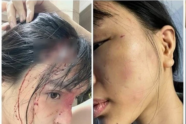 Tài xế xe công nông tử vong trên ghế lái-2