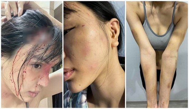 NÓNG: Siêu mẫu Khả Trang công bố quá trình được mẹ đẻ và công an giải cứu sau 2 ngày bị giam lỏng hành hung-4