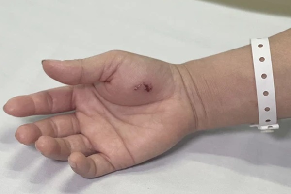 Hà Nội: Người phụ nữ đầu tiên bị con cu li cắn, vài phút sau giọng nói yếu hẳn đi-1