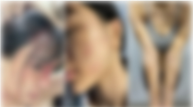 Vụ Khả Trang tố bị chồng giam lỏng, bạo hành dã man: Công an đưa người mẫu đi giám định thương tích-2