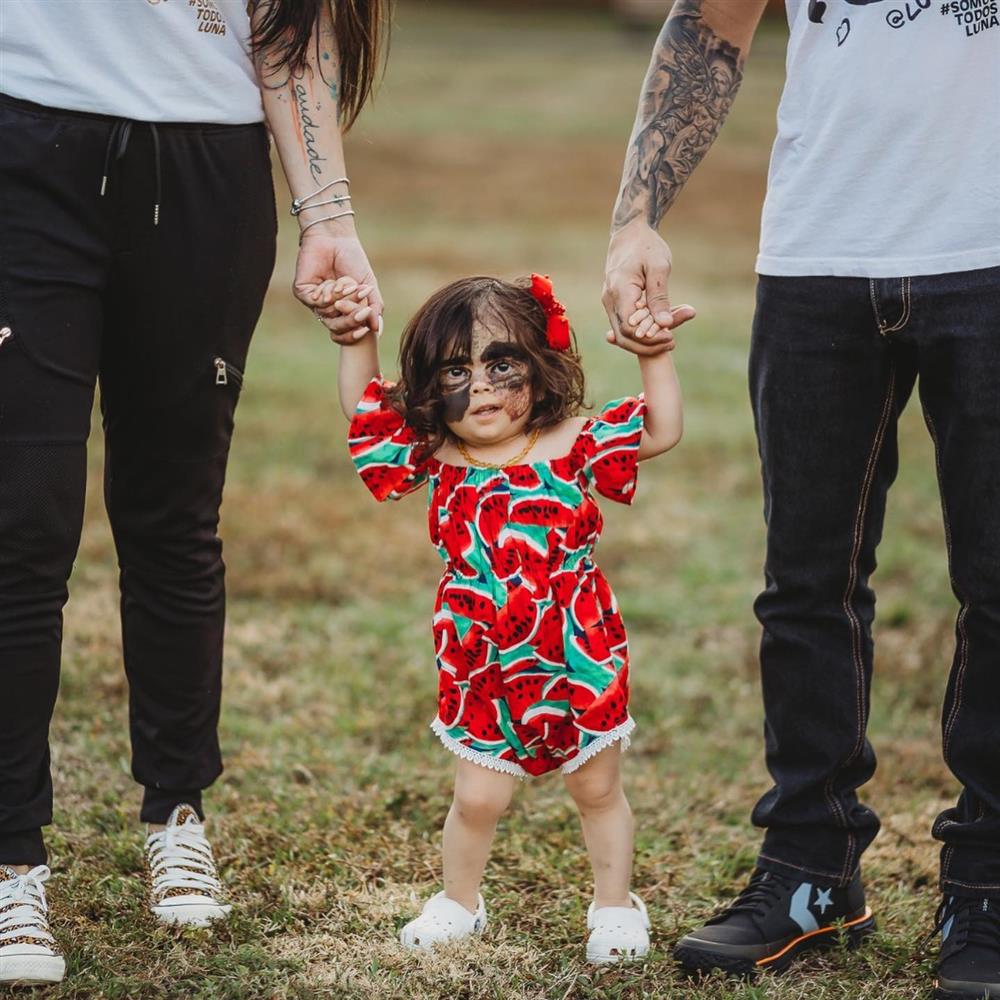 Bé gái có vết bớt đen khổng lồ trên khuôn mặt, gần 3 năm sau diện mạo thay đổi ra sao?-5