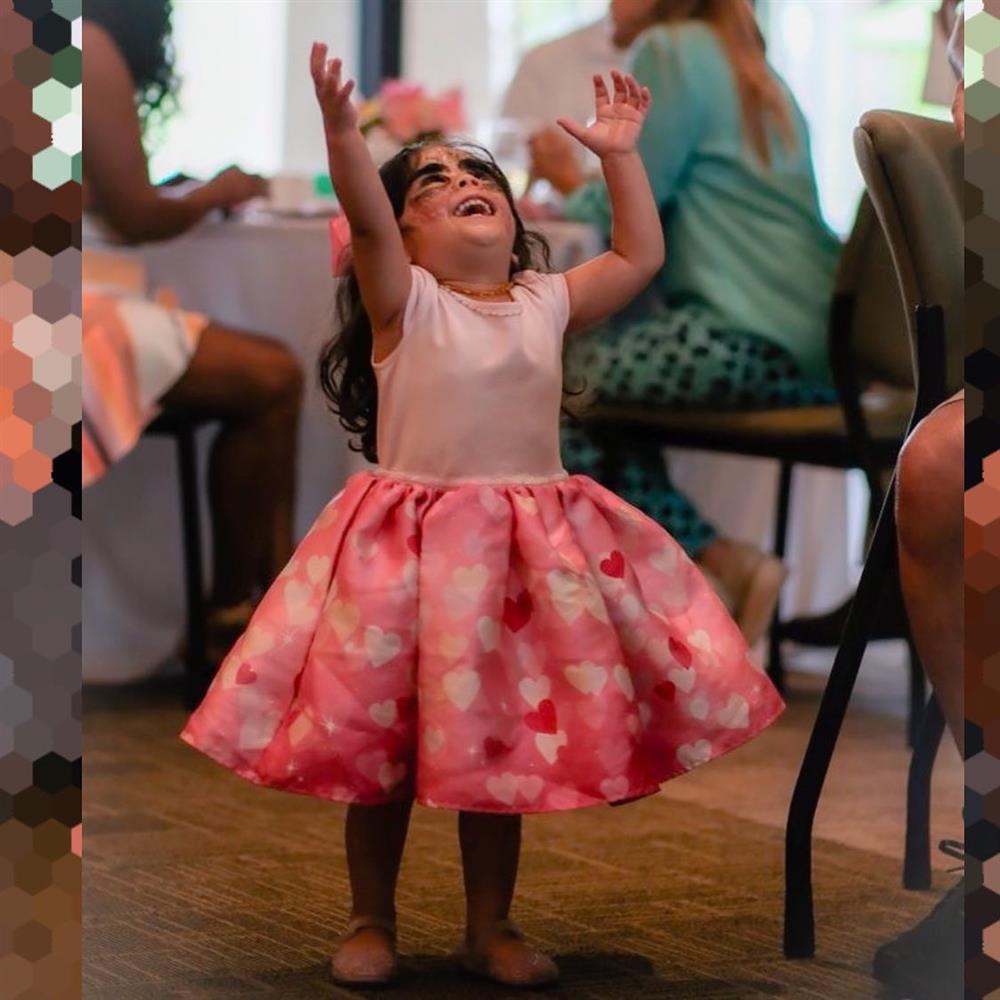 Bé gái có vết bớt đen khổng lồ trên khuôn mặt, gần 3 năm sau diện mạo thay đổi ra sao?-7