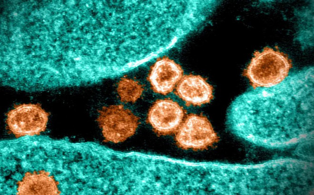 Bữa tiệc Giáng sinh trở thành ổ dịch biến thể Omicron lớn nhất thế giới bên ngoài Nam Phi: Bất ngờ có hy vọng-3