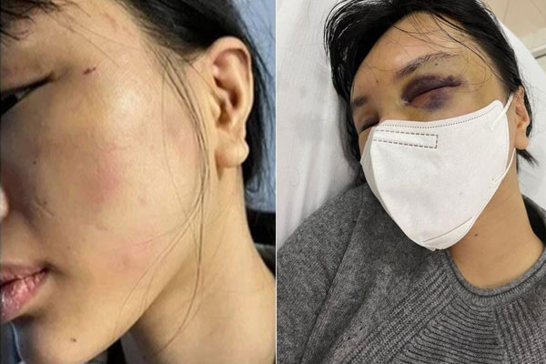 Chồng tuyên bố nhà phải có nóc khi vợ biếu bố đẻ 15 triệu, phản ứng ngay sau đó của cô lại khiến anh xuống giọng-2