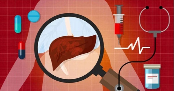 Người đàn ông bị ung thư gan giai đoạn cuối, hối hận vì không làm một việc, nếu thấy 2 dấu hiệu nhất định phải đi khám ngay-1