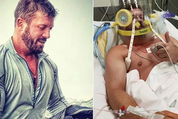 Điều đáng sợ của Covid-19: Đã khỏi nhưng vẫn có triệu chứng lạ lùng mãi không dứt-3