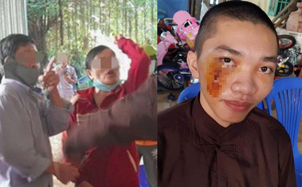 Một người ở Tịnh thất Bồng Lai chuẩn bị ra tòa: Vết thương dài 8 mũi mà đền 8 triệu bạc-1