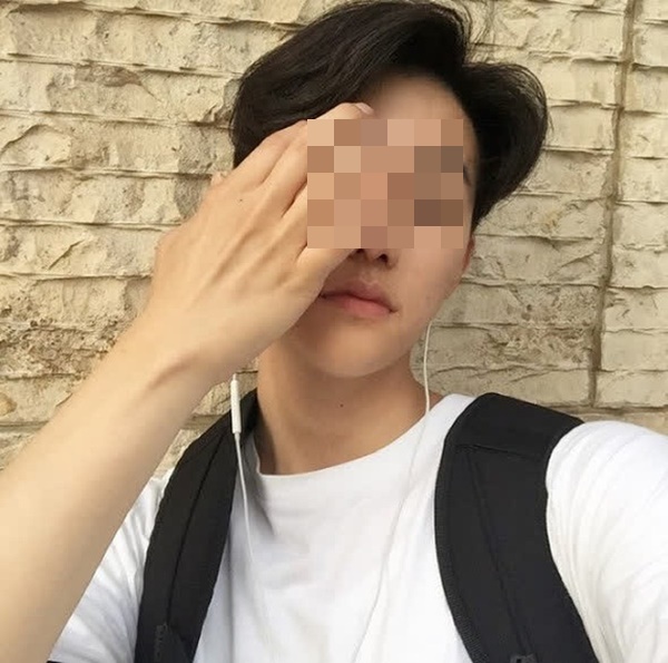 Chàng trai 17 tuổi nhập viện cấp cứu trong tình trạng tai chảy mủ, sốt cao chỉ vì thói quen nhiều bạn trẻ thường làm để giải trí-2