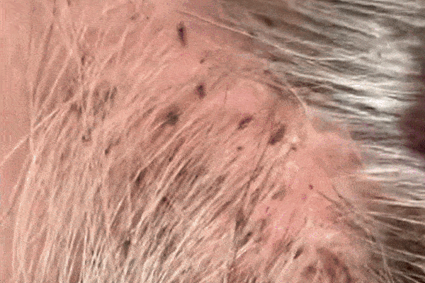 Bé gái mang quả đầu tổ quạ, chấy rận bò xuống cả tay để hút máu khiến chủ tiệm choáng váng lập tức gọi cơ quan bảo vệ trẻ em-4