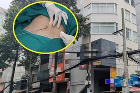Vụ người phụ nữ tử vong sau hút mỡ bụng ở TP.HCM: Nhóm người phẫu thuật không bằng cấp, chứng chỉ và “làm chui”