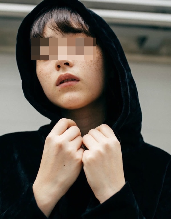 3 bất thường trên mặt ngầm cảnh báo sớm ung thư gan nhưng chúng ta thường bỏ qua-1