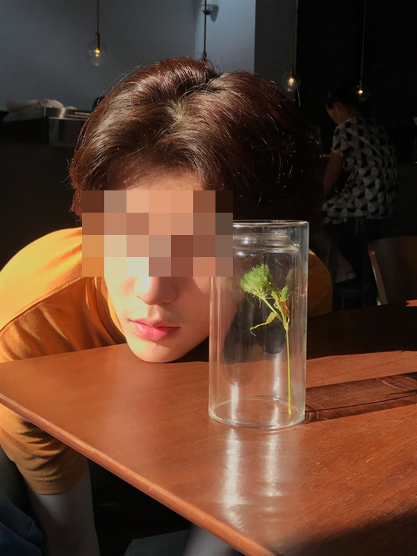 3 bất thường trên mặt ngầm cảnh báo sớm ung thư gan nhưng chúng ta thường bỏ qua-2