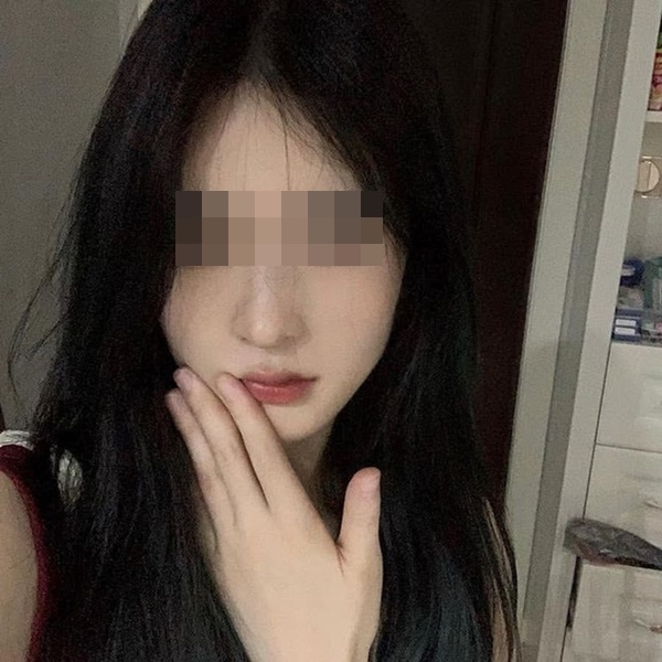 3 bất thường trên mặt ngầm cảnh báo sớm ung thư gan nhưng chúng ta thường bỏ qua-3