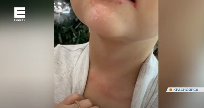 Cậu bé suýt bị treo cổ khi chơi cầu trượt trong tình huống không ai ngờ tới-2