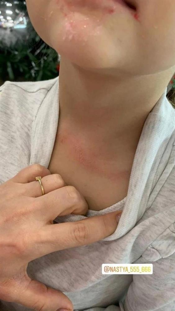 Giơ điện thoại ghi lại khoảnh khắc con chơi trong công viên giải trí, mẹ vô tình quay cảnh con bị siết cổ vì thứ không ngờ tới-3