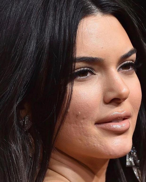 Hung thần ảnh cận mặt tố làn da nhăn của Kim Kardashian, Kendall Jenner-2