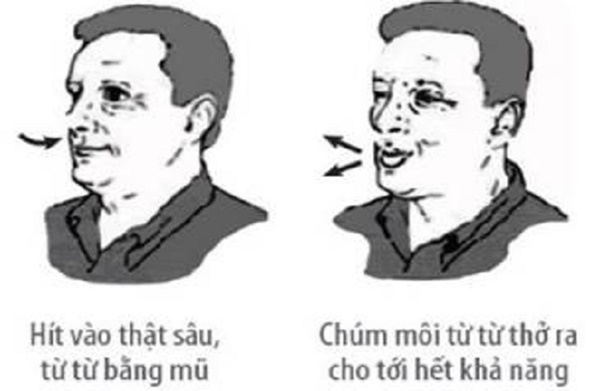 F0 điều trị tại nhà: Nếu có 7 dấu hiệu sau cần báo ngay cho nhân viên y tế-4