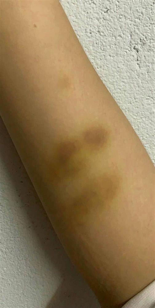 Xôn xao nữ sinh F0 bị chủ trọ hành hung, đuổi đi giữa đêm: Mày phải biến khỏi đây-4