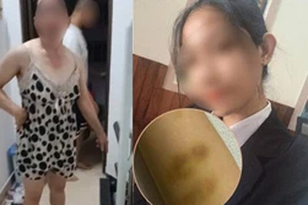 Chính quyền địa phương lên tiếng vụ việc nữ sinh F0 tố bị hành hung, đuổi đi giữa đêm dù đang sốt cao-5