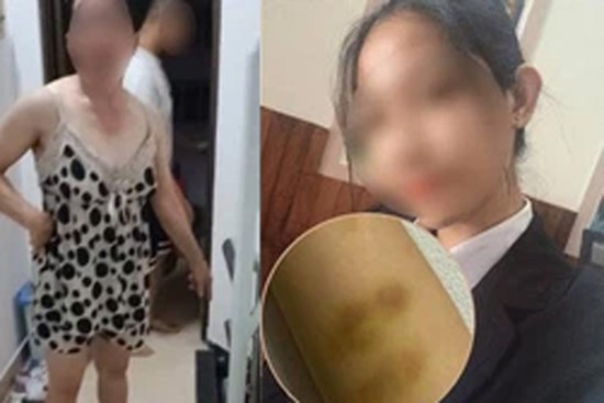 Nữ sinh F0 ở TP.HCM bức xúc kể lại toàn bộ câu chuyện bị mẹ con chủ trọ hành hung, đuổi đi giữa đêm dù đang sốt cao