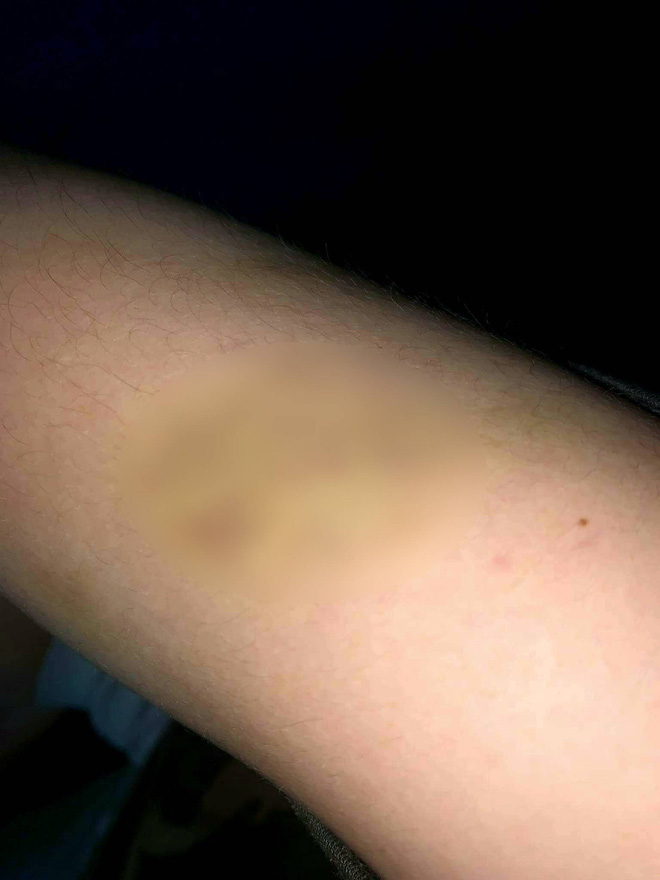 Chính quyền địa phương lên tiếng vụ việc nữ sinh F0 tố bị hành hung, đuổi đi giữa đêm dù đang sốt cao-3