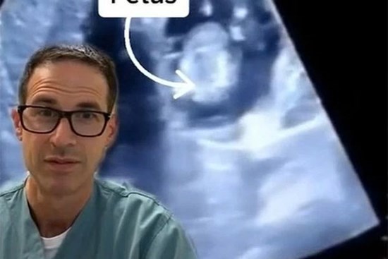 Bị chậm kinh nguyệt 49 ngày, người phụ nữ khiến bác sĩ sốc nặng khi siêu âm