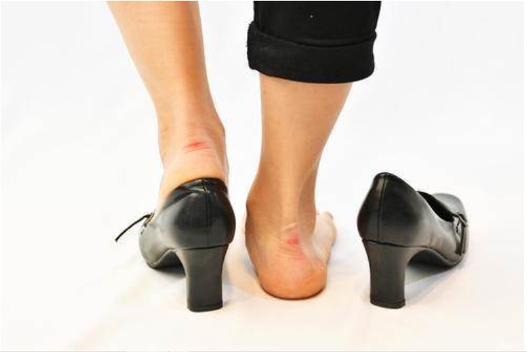 Đi giày cao gót khiến chân bị đau, sưng tấy? Đừng lo, khi biết mẹo nhỏ này dù đi cả ngày chân bạn vẫn luôn thoải mái-1