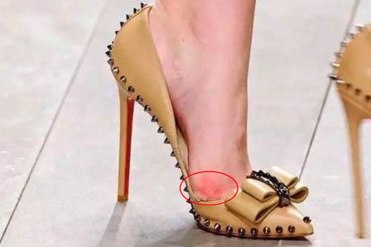 Đi giày cao gót khiến chân bị đau, sưng tấy? Đừng lo, khi biết mẹo nhỏ này dù đi cả ngày chân bạn vẫn luôn thoải mái-3