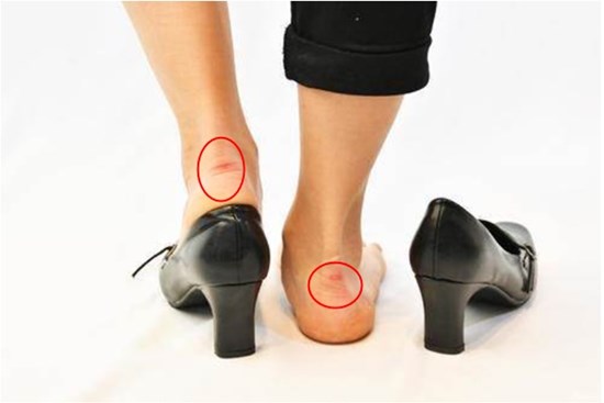 Đi giày cao gót khiến chân bị đau, sưng tấy? Đừng lo, khi biết mẹo nhỏ này dù đi cả ngày chân bạn vẫn luôn thoải mái