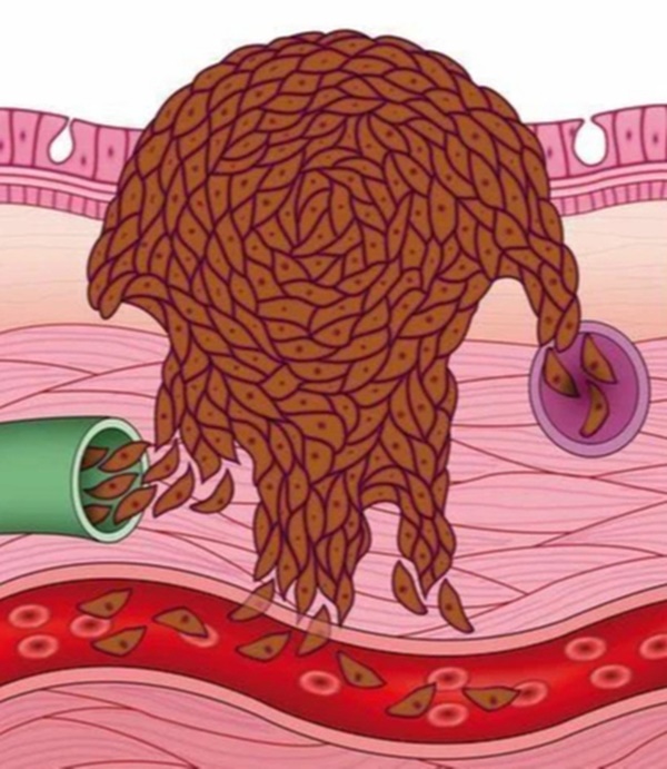 Mạch máu quyết định tuổi thọ, nếu không thông các bộ phận khác không được nuôi dưỡng, làm tốt 5 việc sẽ quét sạch rác thải trong mạch máu-1