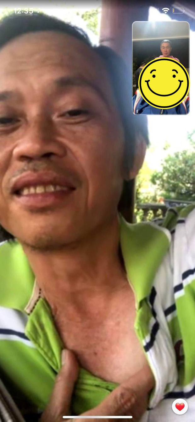 Lan truyền ảnh nghi mới nhất của NS Hoài Linh: Gầy sọp da sạm đi nhiều, đang gọi điện cho bạn thân hậu drama?-1