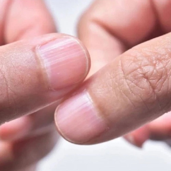 Những người sống thọ trăm tuổi thường có 5 đặc điểm cực kỳ dễ nhận biết trên cơ thể, nếu có đủ tất cả thì bạn rất nên ăn mừng-1