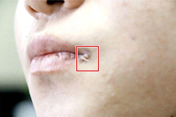 Không muốn nhiễm virus HPV, chị em tuyệt đối đừng làm 3 việc khi quan hệ tình dục-4