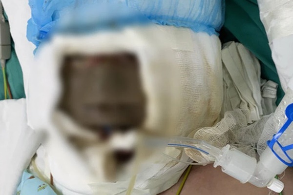 Tín hiệu tích cực về Omicron ở Nam Phi, WHO cảnh báo đừng vội mừng vì lý do sau-2