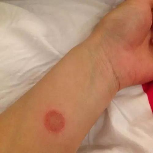 IQ của cô bé 11 tuổi chỉ như trẻ 3 tuổi, nguyên nhân bắt nguồn từ con mèo: Bác sĩ cảnh báo gia đình có trẻ nhỏ nên cẩn thận khi nuôi thú cưng-2