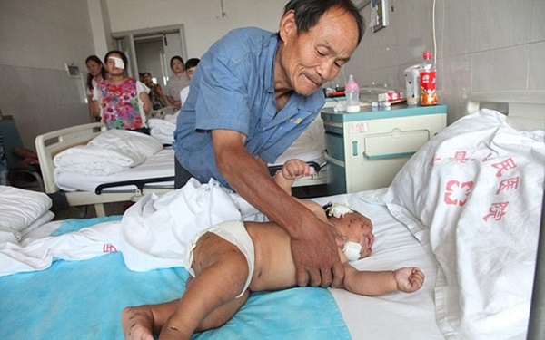 Em bé từng bị mẹ đâm gần 90 nhát kéo vào mặt vì cắn ti khi đang bú khiến dư luận khắp nơi bàng hoàng giờ ra sao?-3