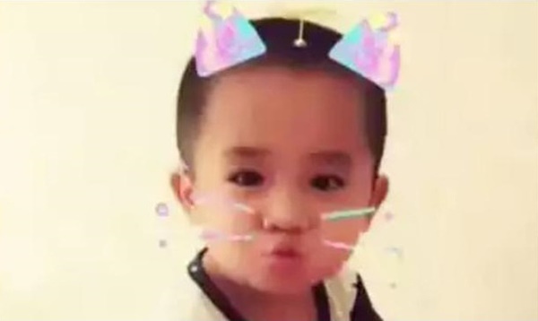 Em bé từng bị mẹ đâm gần 90 nhát kéo vào mặt vì cắn ti khi đang bú khiến dư luận khắp nơi bàng hoàng giờ ra sao?-4