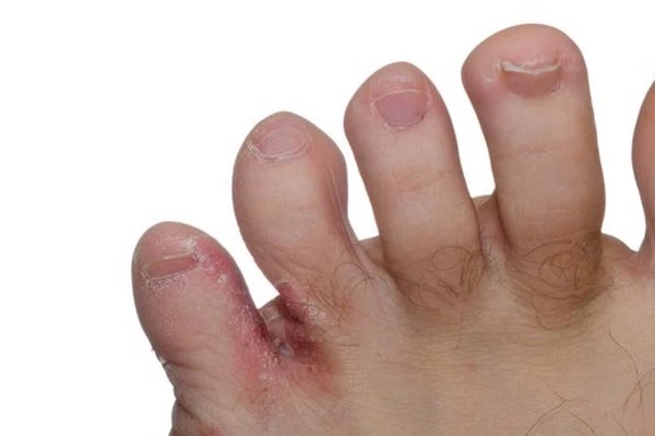 Người mắc bệnh tiểu đường có thể đối mặt với 5 biến chứng rất đáng sợ, cần làm ngay 4 việc để có thể phòng tránh kịp thời-4