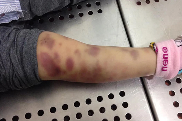 Phẫn nộ với thời gian biểu được cho là của bé gái 8 tuổi tử vong, nghi do dì ghẻ bạo hành-2