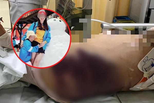 Dân mạng tràn vào Facebook dì ghẻ” 26 tuổi nghi bạo hành bé gái 8 tuổi, đồng loạt thả phẫn nộ-6