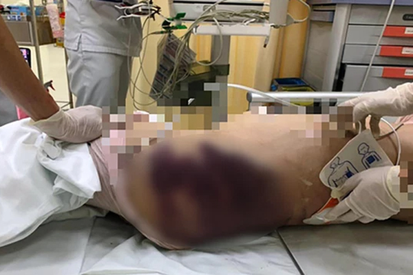 Vụ bé gái 8 tuổi bị bạo hành đến chết: Hàng xóm nhiều lần nghe tiếng mẹ kế la mắng, đánh đập, bắt làm nhiều việc-3