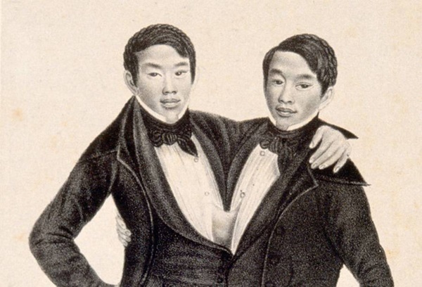 Cặp sinh đôi dính liền nổi tiếng nhất lịch sử: Bị gọi là quái vật” nhưng vẫn thành công rực rỡ, gây tò mò khi lấy 2 vợ riêng biệt, sinh tù tì 21 con-1