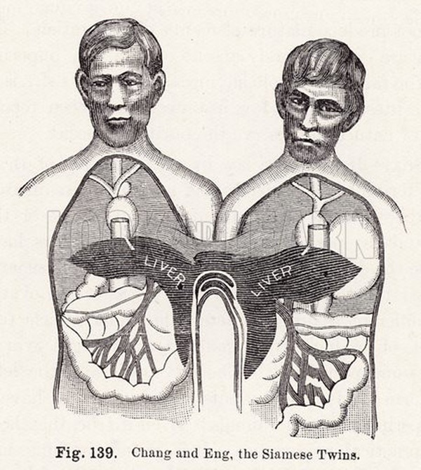 Cặp sinh đôi dính liền nổi tiếng nhất lịch sử: Bị gọi là quái vật” nhưng vẫn thành công rực rỡ, gây tò mò khi lấy 2 vợ riêng biệt, sinh tù tì 21 con-5