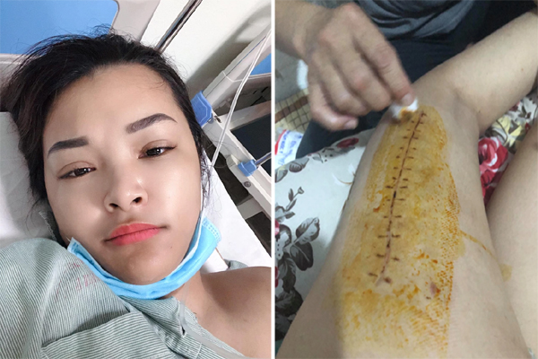 Hà Nội dự báo tăng lên 2.000 - 3.000 ca Covid-19 mỗi ngày dịp cuối năm, quận/ huyện nào hiện có nhiều F0 nhất?-4