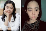 Căn bệnh khiến 'em gái quốc dân' Moon Geun Young trông như U50: Dấu hiệu dễ bỏ qua, phụ nữ nào cũng có thể mắc